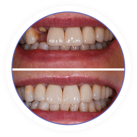 family dental justin tx